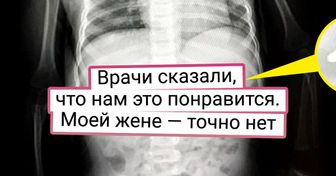 18 случаев, когда рентген и УЗИ показали мир под таким углом, под каким обычному глазу ничего не разглядеть