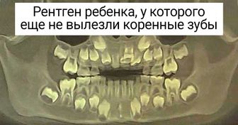 15 рентгеновских снимков, которые показывают скрытые стороны нашей жизни