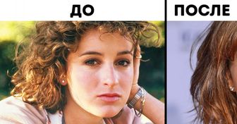 Как выглядели 10 звезд до того, как обратились к пластическим хирургам